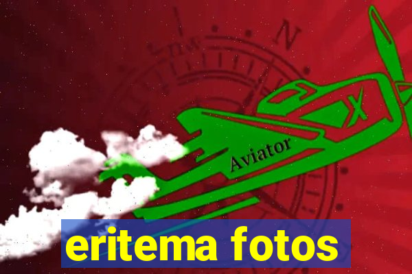 eritema fotos